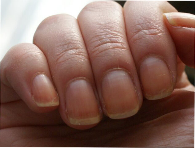 Фото 1 - Как восстановить и укрепить ногти после гель-лака